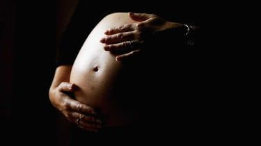 „Tehotná“ žena mala 26 kg ovariálnu cystu