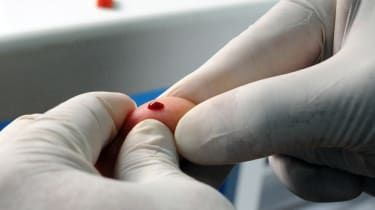 Kahdeksan naista sai HIV-positiivisen hautajaispaljastuksen jälkeen