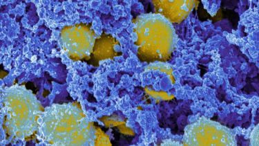 Skanningselektromikrografi av Staphylococcus aureus-bakterier