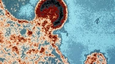 Nuo ŽIV „išgydyto“ kūdikio testas buvo teigiamas dėl viruso