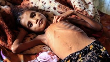 Se critica al gobierno por recortar la ayuda a la 'superpotencia de la pobreza' en Yemen