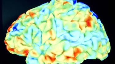Image du cerveau