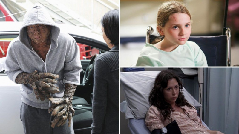 8 storie di 'Grey's Anatomy' ispirate ai casi medici della vita reale
