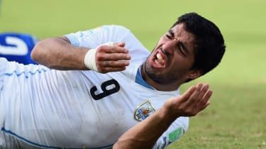 Dåliga tänder kan påverka kvaliteten på Premier League