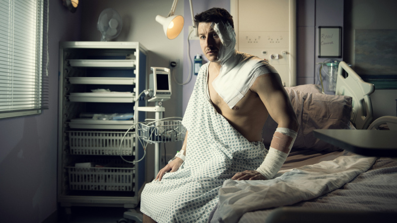   Ryan Connor la spital acoperit cu bandaje după atacul cu acid